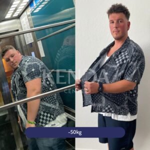 Non-invasive body contouring before and after results Oldham | non-invasive weight loss treatment