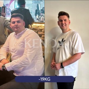 Non-invasive body contouring before and after results Oldham | non-invasive weight loss treatment